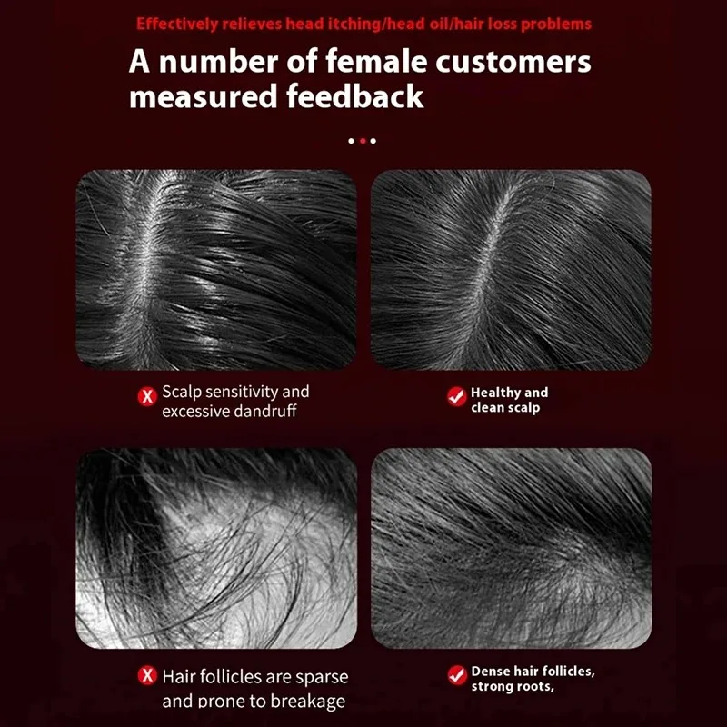 Cepillo de Masaje Eléctrico co - Hair Care For Hair Loss reseña y precio