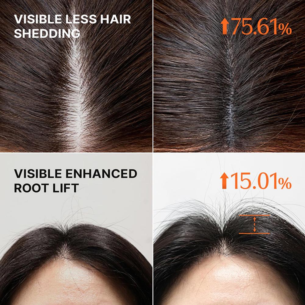 GROW:TURN Champú Voluminizador - Hair Care For Hair Fall reseña y precio