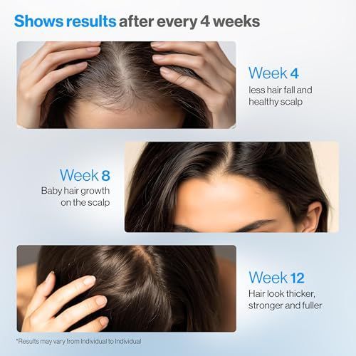 Suero Premium de Romero Antica - Hair Care For Hair Fall reseña y precio