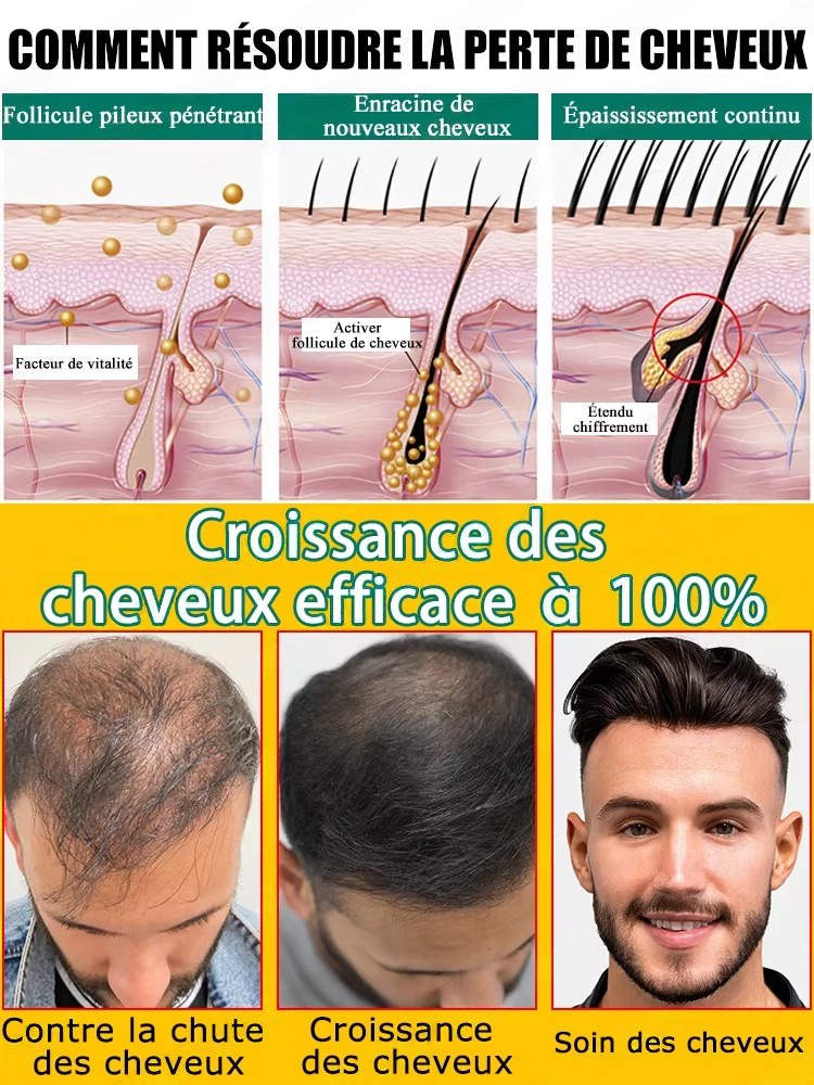 Esencia natural para el cuidad - Hair Care For Hair Fall reseña y precio