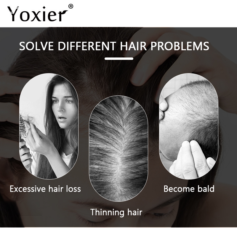 Suero de crecimiento intensivo - Hair Care For Hair Loss reseña y precio