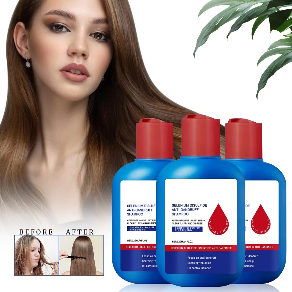Nuevo Champú Nipori de 120 ml, - Hair Care Dandruff reseña y precio