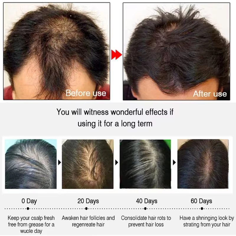 Spray de Crecimiento Rápido de - Hair Care For Hair Loss reseña y precio