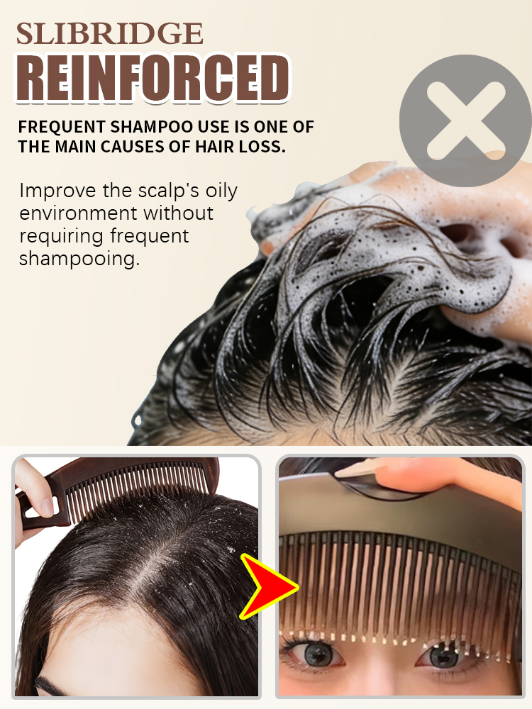 Peine para Eliminar Grasa del  - Hair Care Dandruff reseña y precio