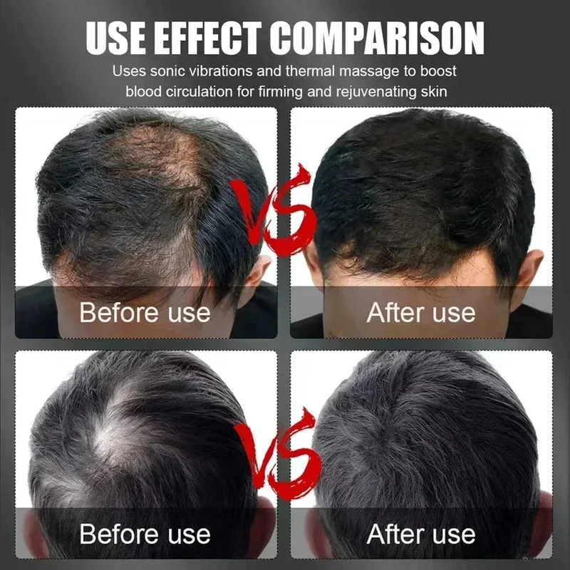 Gorro de Terapia Capilar con L - Hair Care For Hair Loss reseña y precio